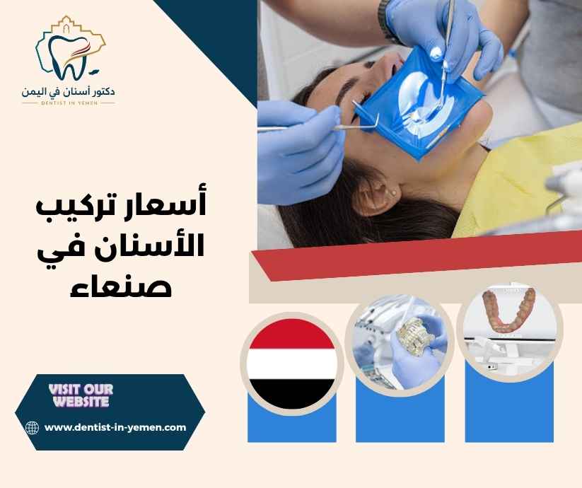 تكلفة التيجان والجسور السنية تكلفة التيجان والجسور السنية
