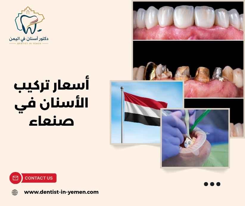 أسعار التركيبات الثابتة والمتحركة أسعار التركيبات الثابتة والمتحركة