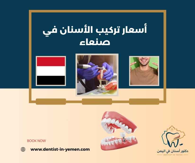كيفية اختيار التركيبة المناسبة للميزانية كيفية اختيار التركيبة المناسبة للميزانية