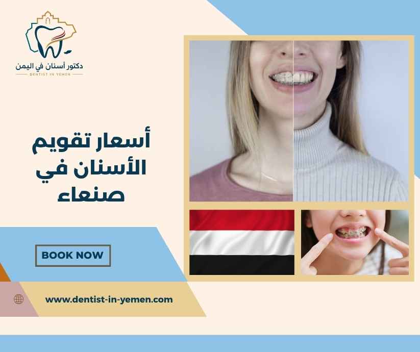 أسعار تقويم الأسنان في صنعاء أسعار تقويم الأسنان في صنعاء