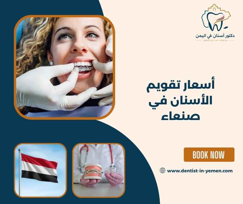 سعر التقويم المعدني والشفاف سعر التقويم المعدني والشفاف