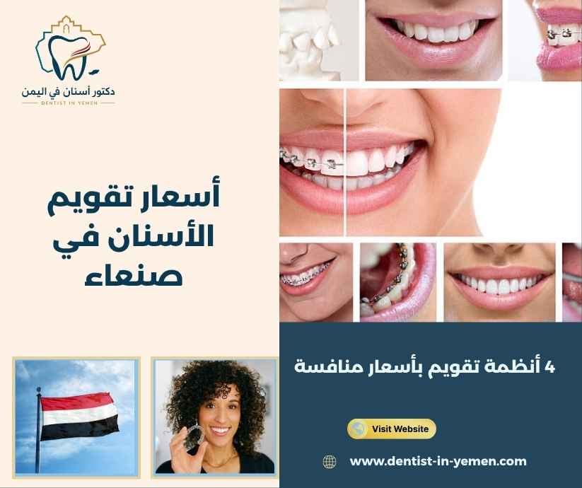 أسعار تقويم الأسنان في صنعاء