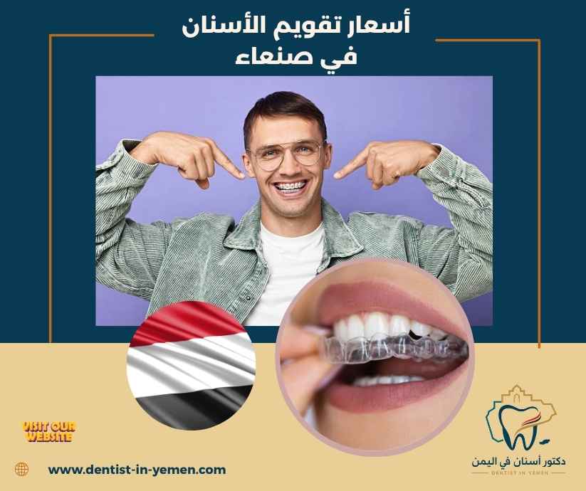 أسعار تقويم الأسنان في صنعاء أسعار تقويم الأسنان في صنعاء