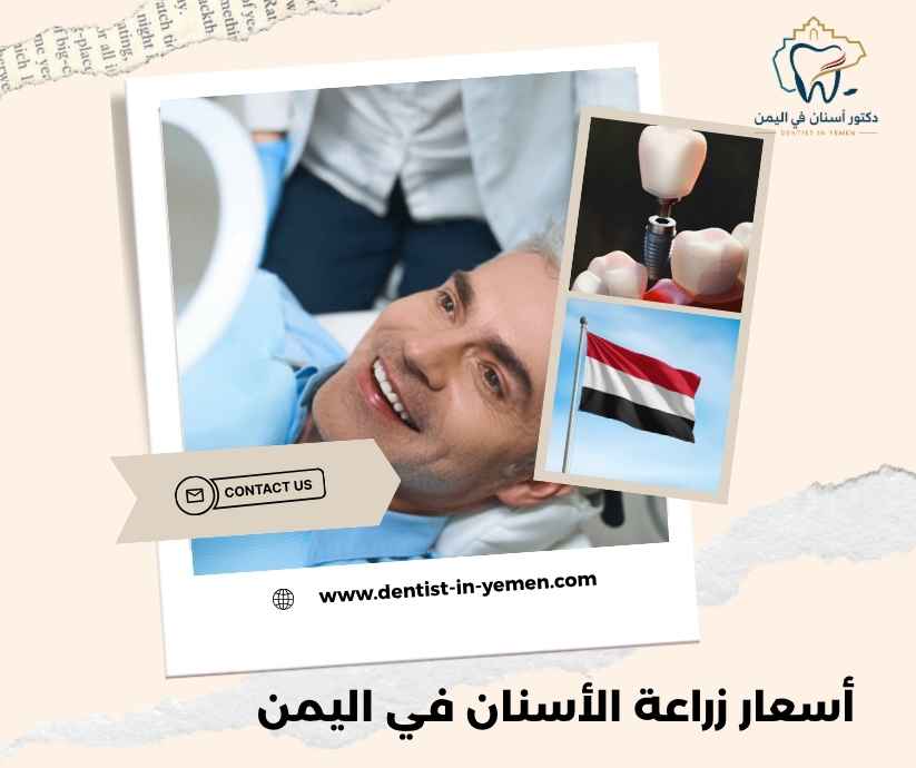 أسعار زراعة الأسنان في اليمن أسعار زراعة الأسنان في اليمن