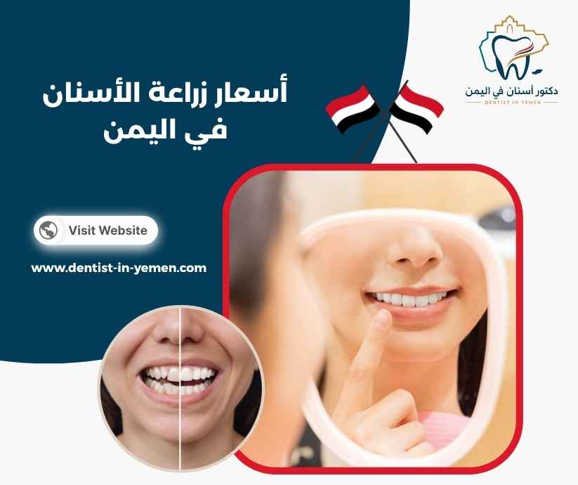 أسعار زراعة الأسنان في اليمن أسعار زراعة الأسنان في اليمن