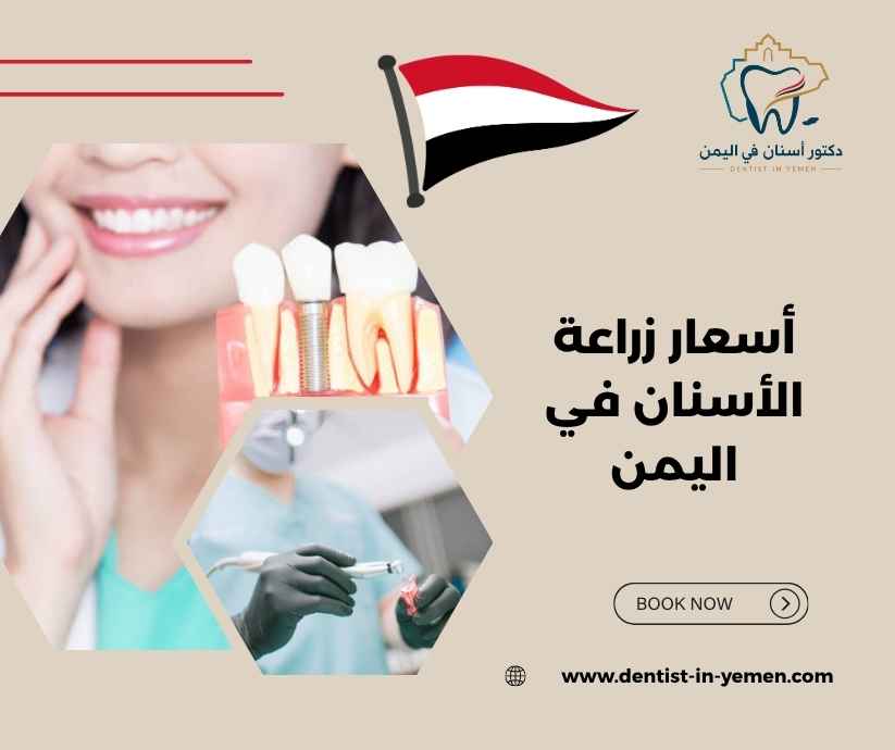 بعض تجارب المرضى مع افضل أسعار زراعة الأسنان في اليمن بعض تجارب المرضى مع افضل أسعار زراعة الأسنان في اليمن