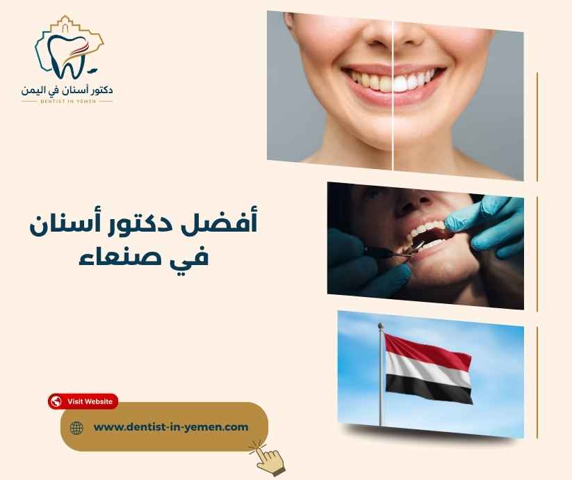 أفضل دكتور أسنان في صنعاء أفضل دكتور أسنان في صنعاء