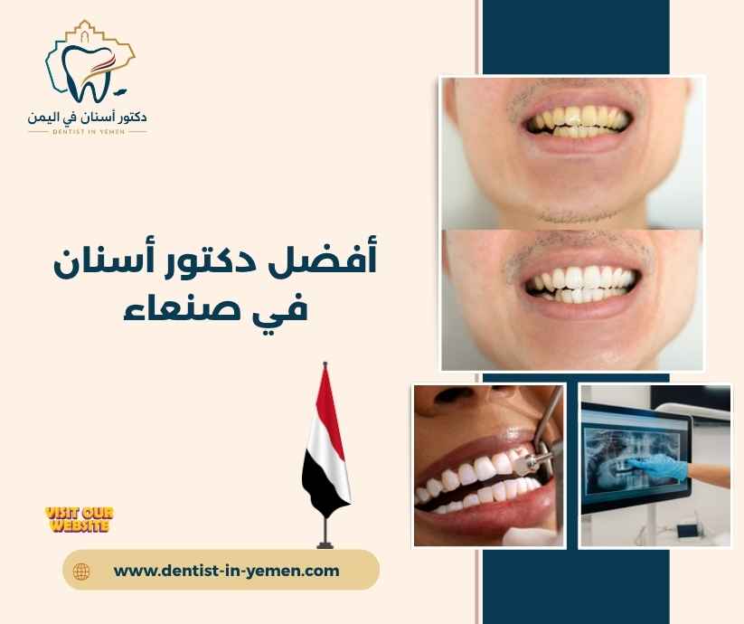 أفضل دكتور أسنان في صنعاء