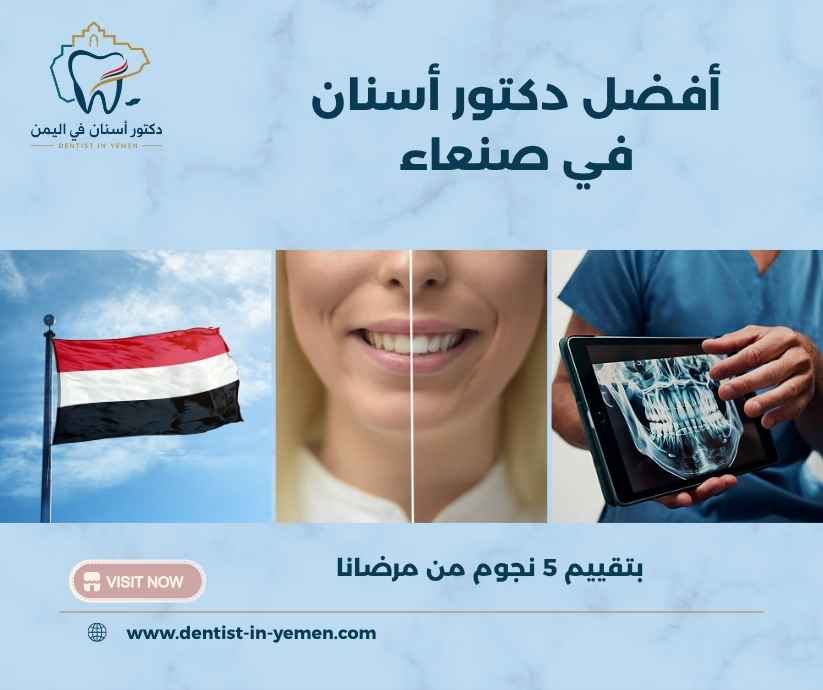 أفضل دكتور أسنان في صنعاء