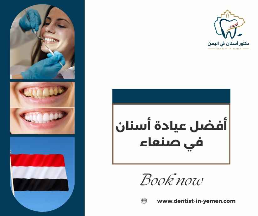 أفضل عيادة أسنان في صنعاء