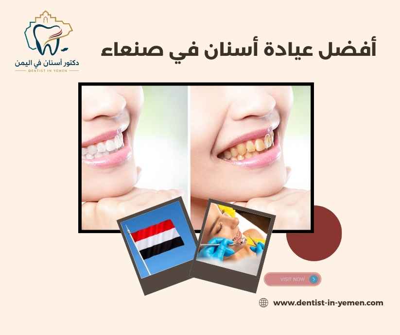 أفضل عيادة أسنان في صنعاء