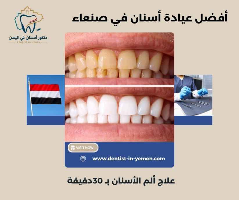 أفضل عيادة أسنان في صنعاء