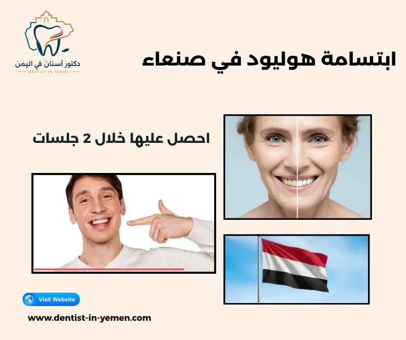 ابتسامة هوليود في صنعاء