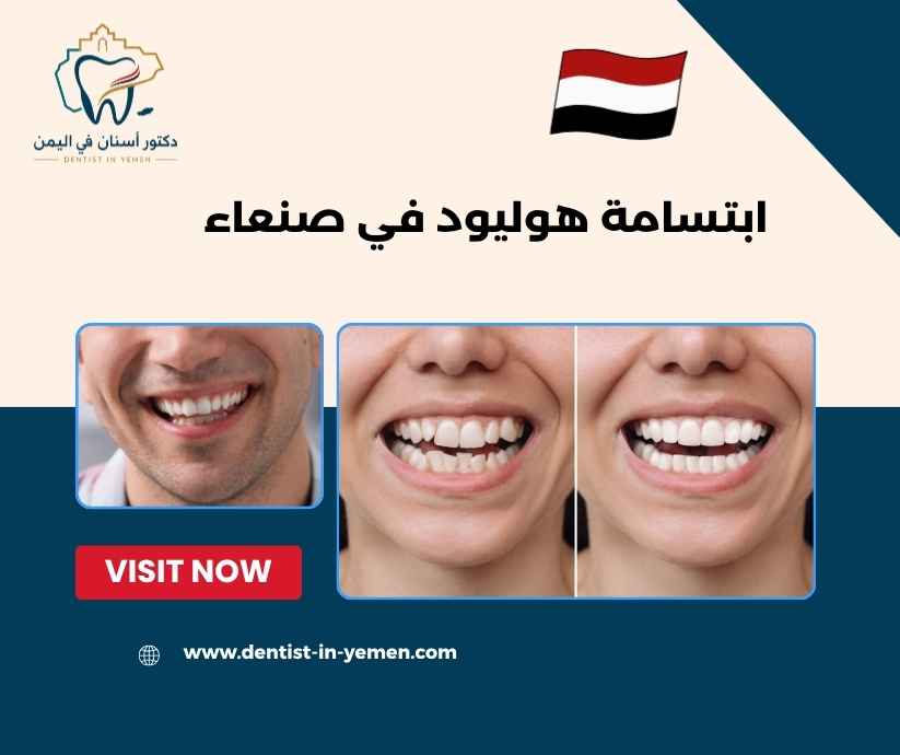 ابتسامة هوليود في صنعاء