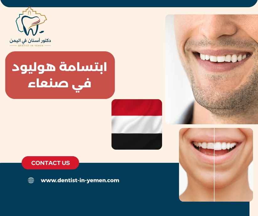 ابتسامة هوليود في صنعاء