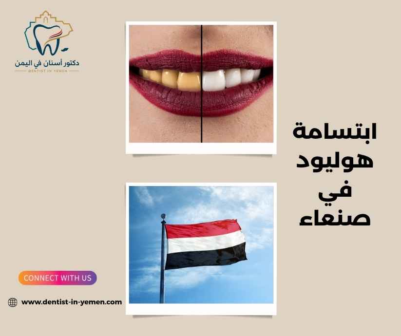 ابتسامة هوليود في صنعاء