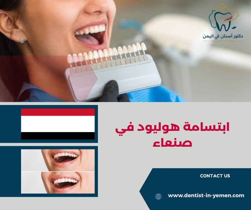 ابتسامة هوليود في صنعاء
