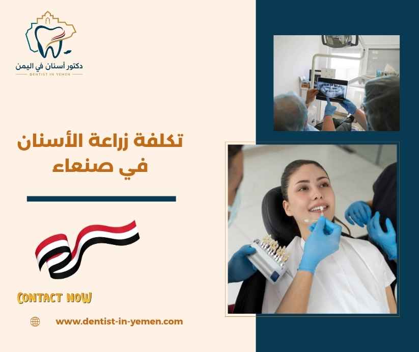 أثر حالة عظم الفك في التكلفة