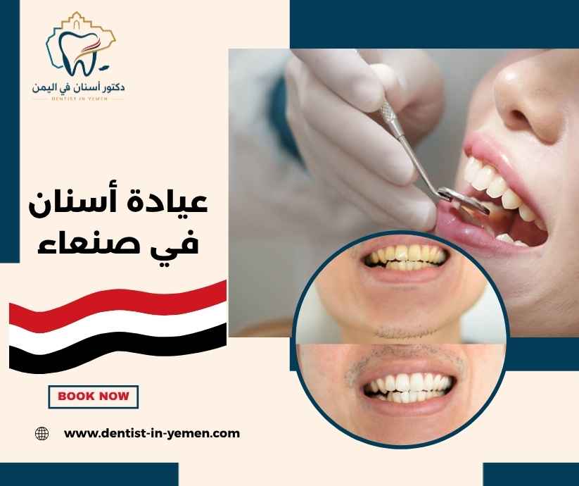 عيادة أسنان في صنعاء 